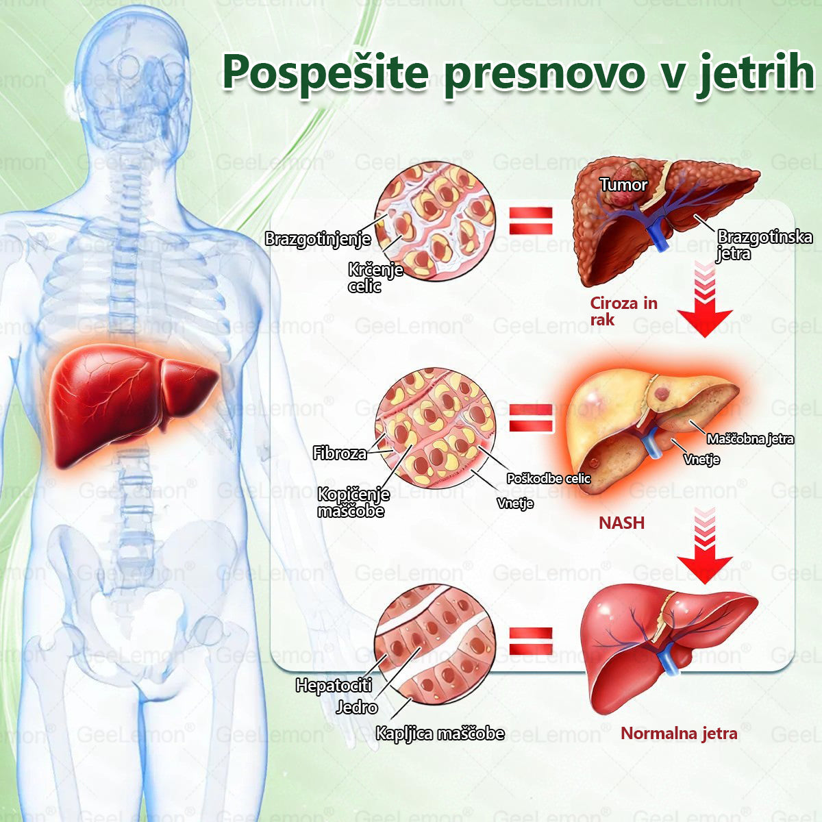 Registrirano pri JAZMP in GMP certificirano👩‍⚕️🎁 𝐆𝐞𝑒𝐿𝑒𝐦𝐨𝐧® 𝐆𝐥𝐮𝐦𝐚𝐬𝐞𝐭𝐢𝐝𝐞 8 v 1 Hujševalni in zdravju namenjen nano obliž z mikroiglicami 2.🇸🇮 (Samo enkrat na dan, vidne spremembe že v 7 dneh)