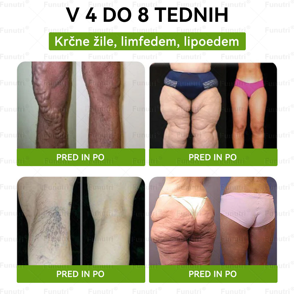 Priporočajo slovenski strokovnjaki 💖 Funutri® 10-v-1 nano-mikroiglični obliž za podporo presnovi in uravnavanje telesne teže