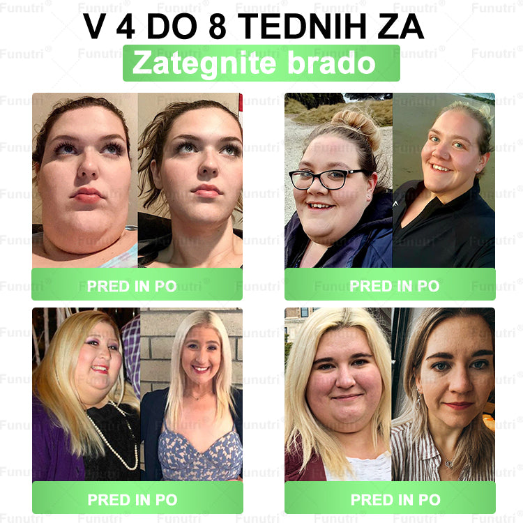 Priporočajo slovenski strokovnjaki 💖 Funutri® 10-v-1 nano-mikroiglični obliž za podporo presnovi in uravnavanje telesne teže