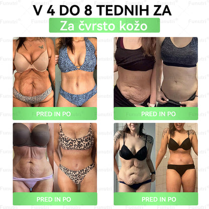 Priporočajo slovenski strokovnjaki 💖 Funutri® 10-v-1 nano-mikroiglični obliž za podporo presnovi in uravnavanje telesne teže